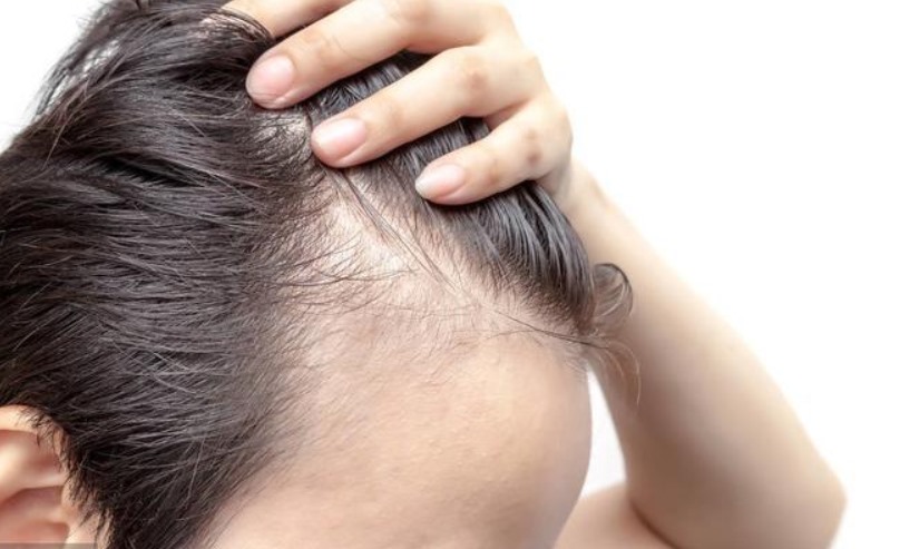 如何预防脱发和促进头发生长（多种方法让头发更健康）