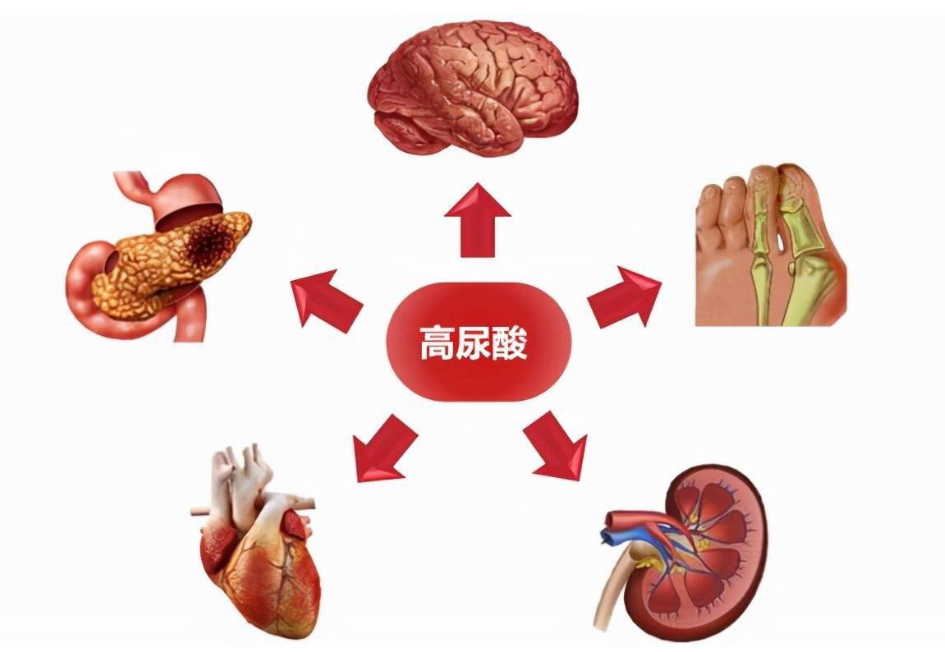 尿酸高不能吃什么食物（列举尿酸高者应避免或限制的食物清单）