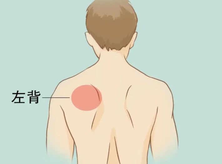 后背疼痛要警惕的三种病(警示可能引起后背疼痛的疾病)